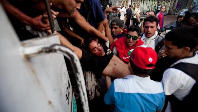 aptopix-venezuela-protests